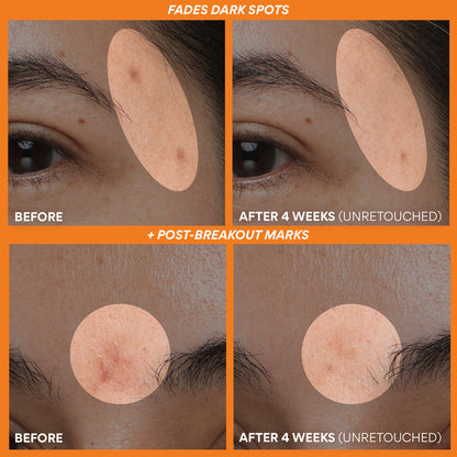 INNISFREE Green Tea Enzyme + Vitamin C Aydınlatıcı Serum 30 mL